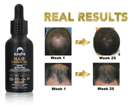 Elevate Hair Regrowth Treatment 5% Minoxidil with Biotin Serum – Thicker, Fuller Hair for Men & Women