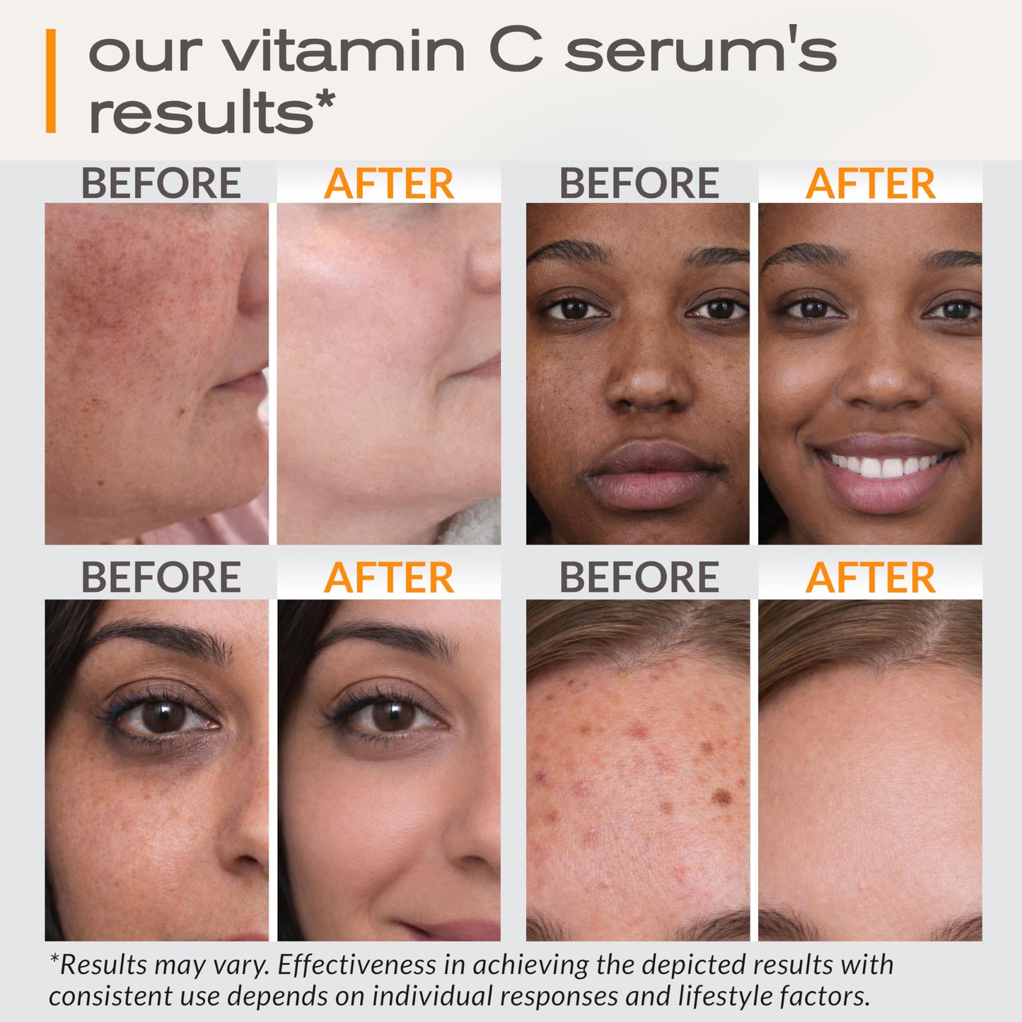 Ella & Eden Vitamin C Serum for Face – Hydrating, Brightening, Fragrance-Free (1 Fl Oz)
