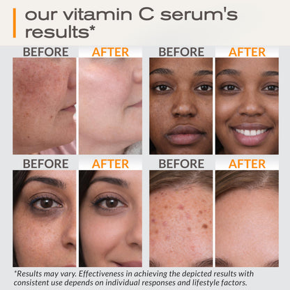 Ella & Eden Vitamin C Serum for Face – Hydrating, Brightening, Fragrance-Free (1 Fl Oz)