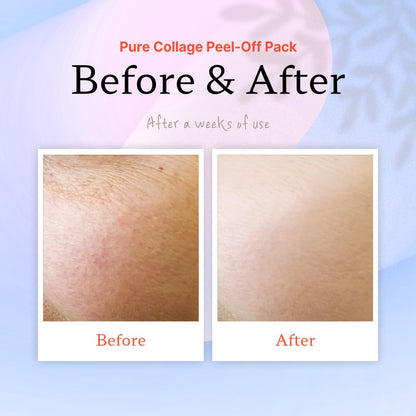 ELT Pure Collagen Peel-Off Mask Pack (2 Count) – 5 Collagens, 8-Peptide Complex, Brush