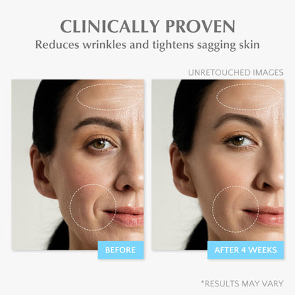 EnaSkin Retinol Collagen Face Cream – 2% Retinol, 7% Hyaluronic Acid, Day/Night Anti-Aging Moisturizer, 1.7 oz