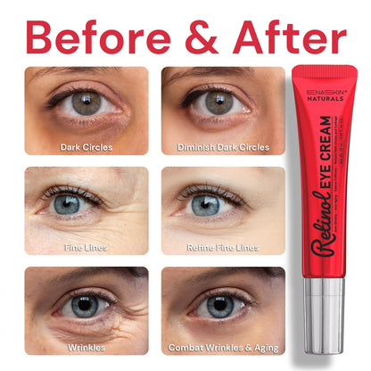 Enaskin Naturals Retinol Eye Cream – Anti-Aging Under Eye Treatment, Dark Circles & Puffiness, 0.85 fl oz
