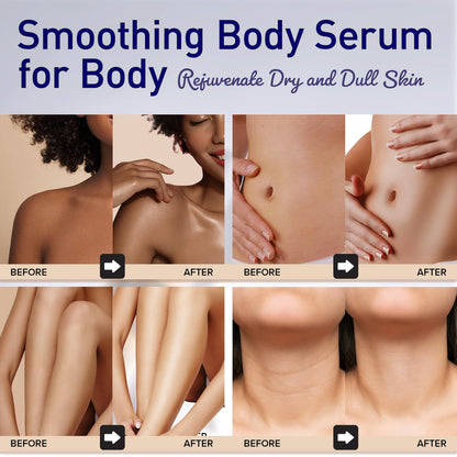 Enaskin Naturals Smoothing Body Serum Lotion – Hydrating Anti-Wrinkle Firming with Hyaluronic Acid & Niacinamide