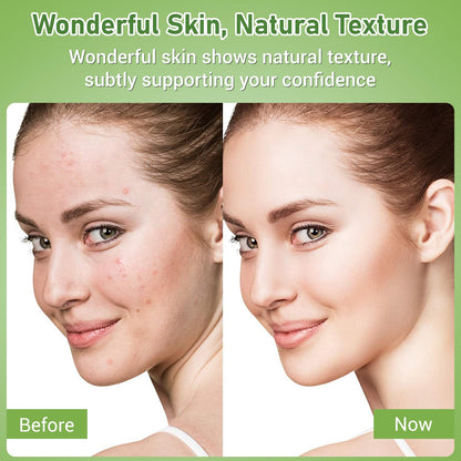 Eofot 14% Azelaic Acid Cream – Clearer-Looking Pores, Even Tone, Gentle Formula | 1 Fl Oz