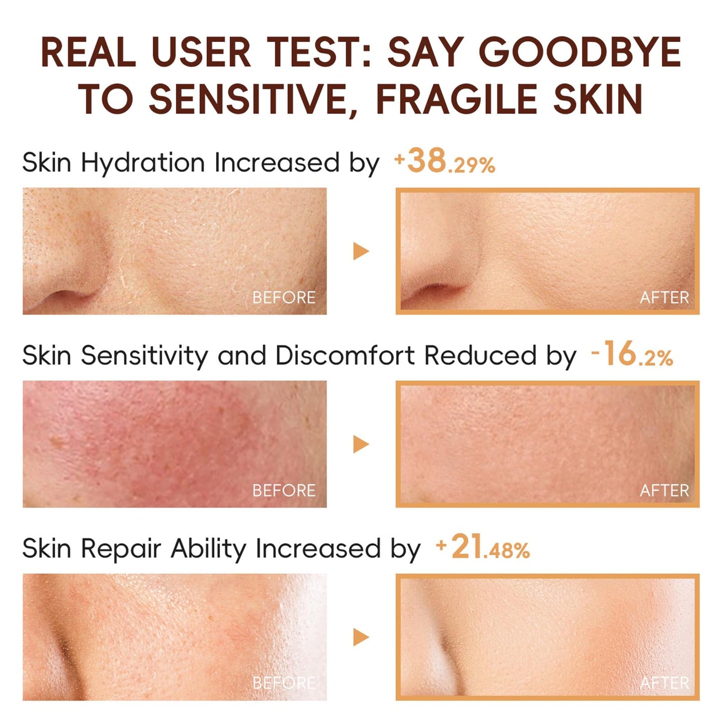 EONFAVE Rice Skincare Set for Teens — Hydrating Routine Kit (Cleanser, Serum, Sunscreen)