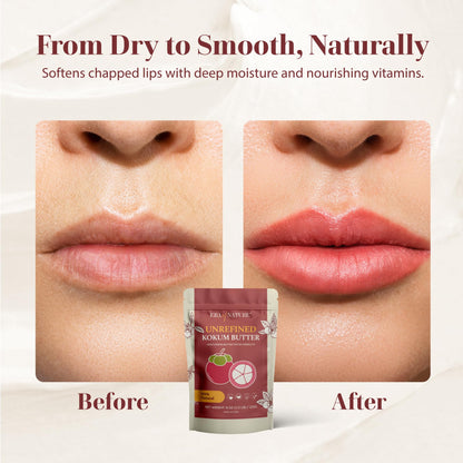 era of nature Kokum Butter Raw 8 oz – Pure DIY Skincare Base for Belly, Body & Lip Care