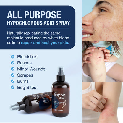 Era Organics Happy Skin HOCl Spray – Extra Strength Gentle Face Cleanser for Acne, Dry & Sensitive Skin | 4 oz