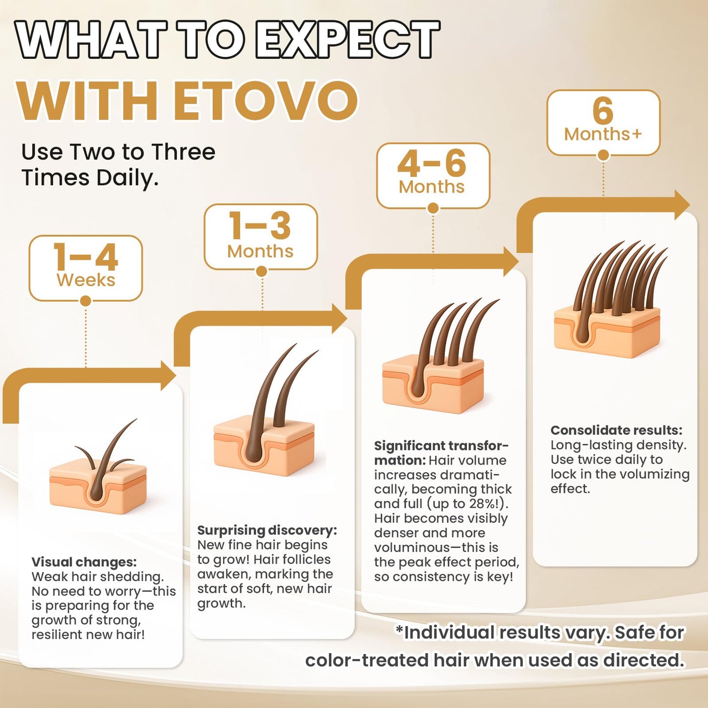 ETOVO 5% Minoxidil for Women – Hair Growth Serum for Thicker, Fuller Hair