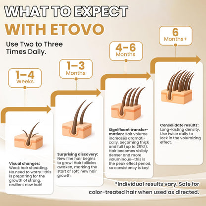 ETOVO 5% Minoxidil for Women – Hair Growth Serum for Thicker, Fuller Hair