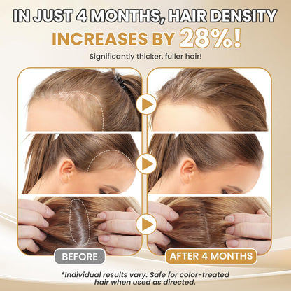 ETOVO 5% Minoxidil for Women – Hair Growth Serum for Thicker, Fuller Hair