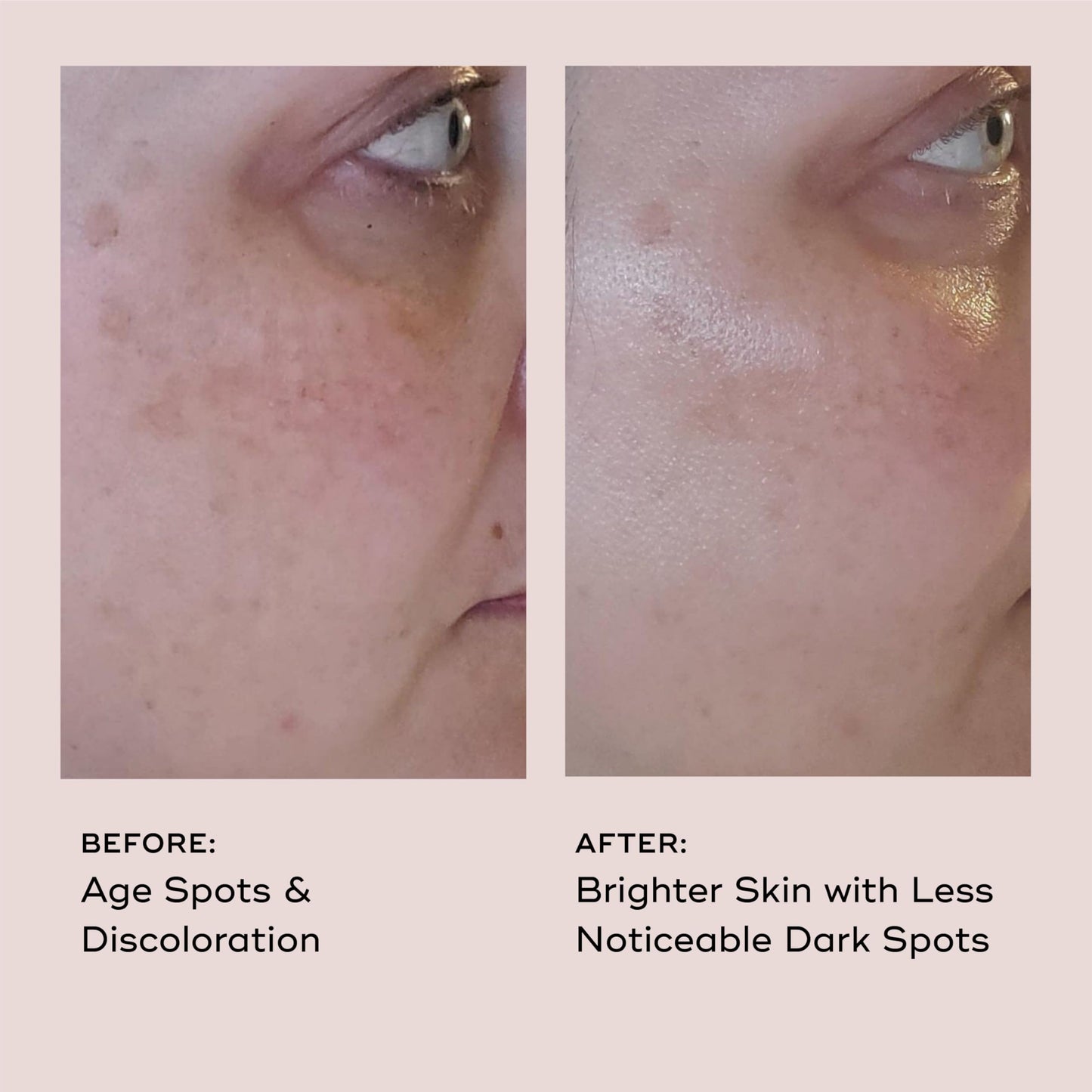 EVER Vitamin C Dark Spot Serum – Brightening, Anti-Aging, 10% Vitamin C | 1 oz