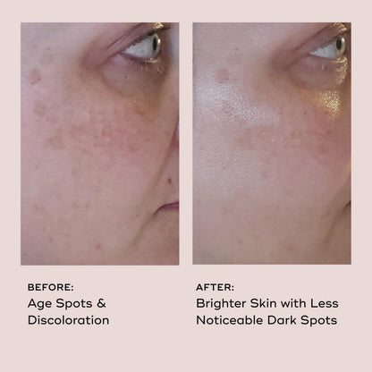 EVER Vitamin C Dark Spot Serum – Brightening, Anti-Aging, 10% Vitamin C | 1 oz