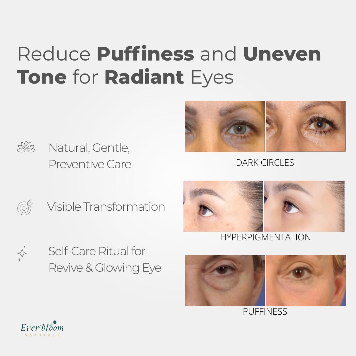 Everbloom Naturals Tranexamic Eye Serum Roller — Bakuchiol, Argireline & Caffeine for Dark Circles