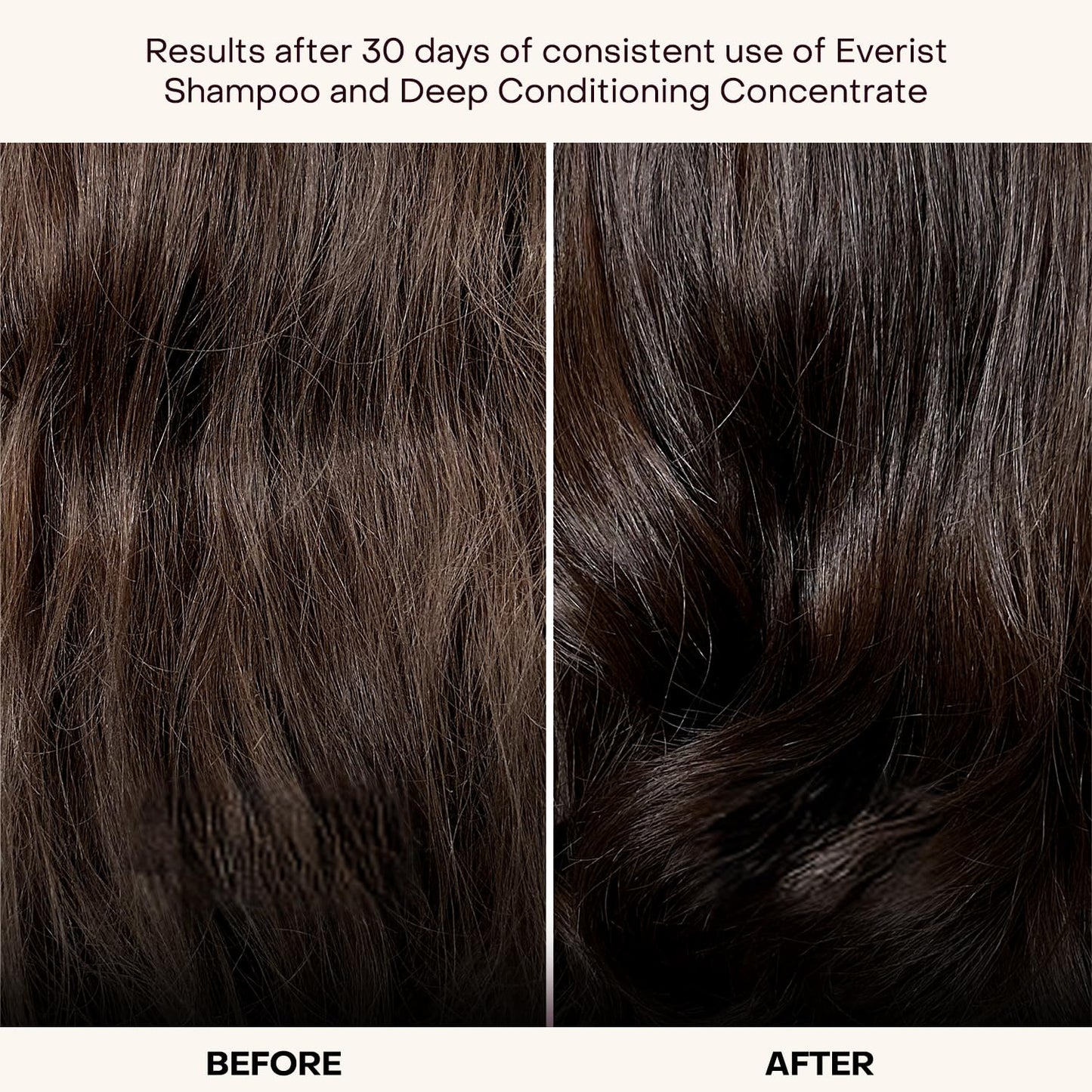 Everist Haircare Essentials Duo – Shampoo & Deep Conditioner for Sensitive Scalp