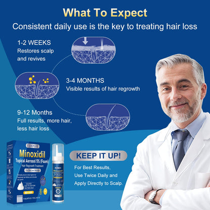 Exdeploy 5% Minoxidil Foam for Men – 5-Pack with Biotin (10.5 oz total)