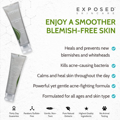 Exposed Skin Care Acne Treatment Serum with 3.5% Benzoyl Peroxide – Lightweight Spot Treatment for Teens, Adults, Hormonal & Cystic Acne – Cruelty Free