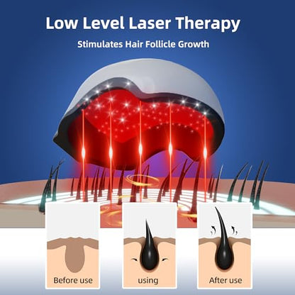faq101 Hair Growth Device with Laser Red Light Therapy – FDA Cleared