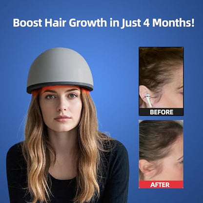 faq101 Hair Growth Device with Laser Red Light Therapy – FDA Cleared
