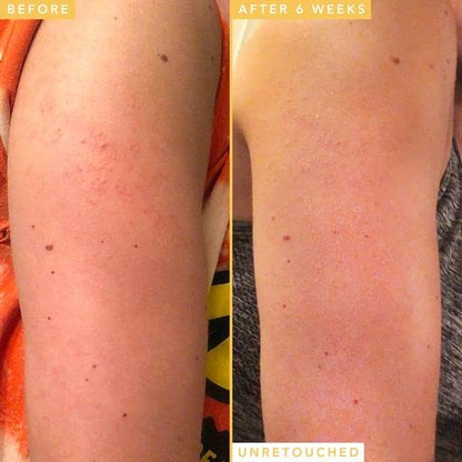 Farmacy Honeymoon Glow Body - AHA/BHA Serum with Hyaluronic Acid