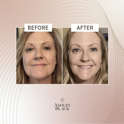 FasciaBlaster Extreme Tightening Serum by Ashley Black – Instant Tightening Up To 6 Hours, No Residue