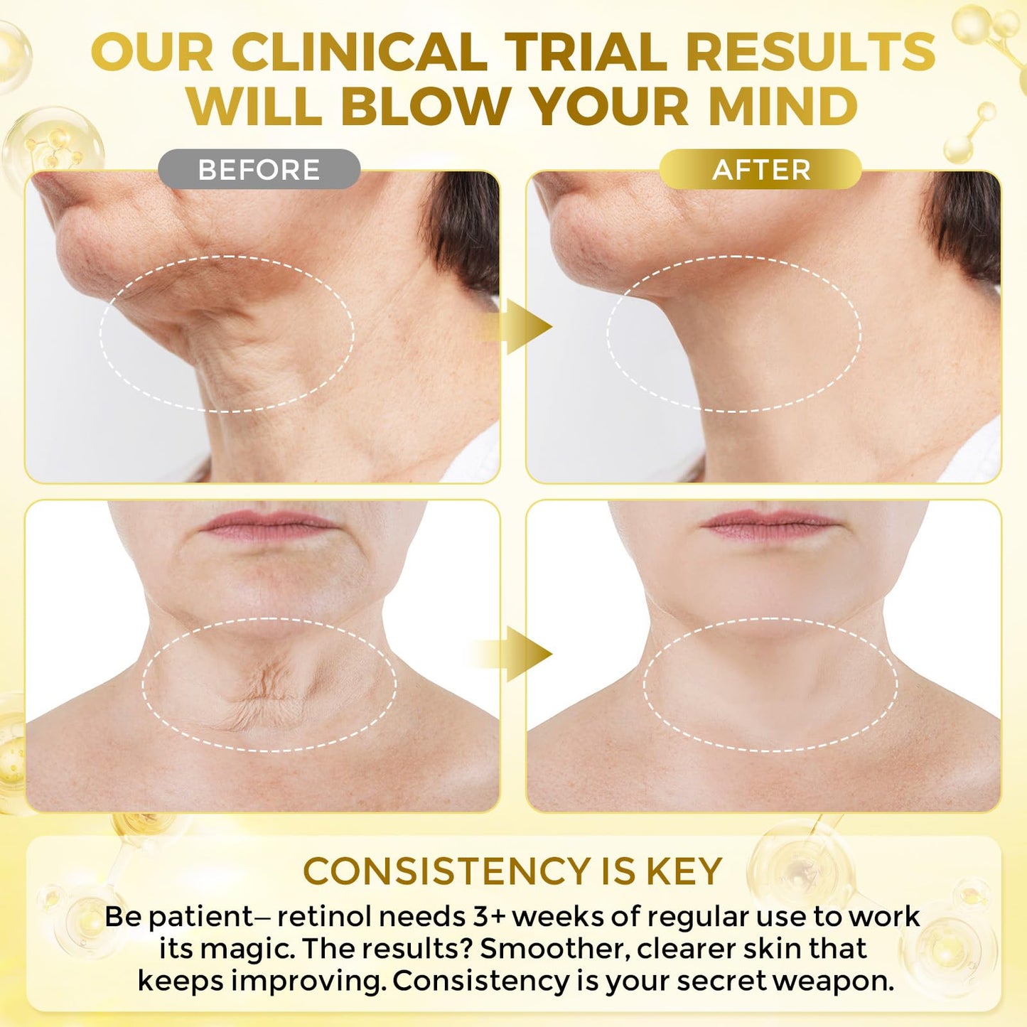 FeeMeFee Neck Firming Cream - Retinol, Peptides & Hyaluronic Acid
