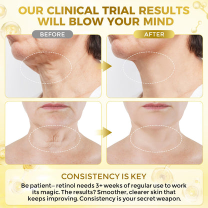 FeeMeFee Neck Firming Cream - Retinol, Peptides & Hyaluronic Acid