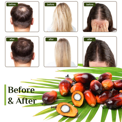 FEIBTH Raw Batana Oil for Hair Growth – Organic Batana Oil, Scalp Nourishment, Thicker Hair