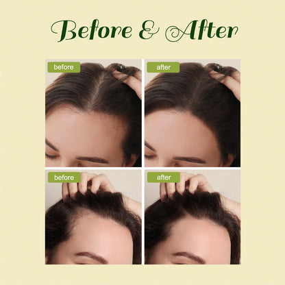 FEIBTH Natural Hair Growth Oil – Batana & Rosemary, 1 fl oz