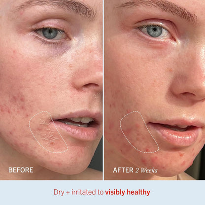First Aid Beauty Ultra Repair Cream – 14 oz Vanilla Cinnamon | Deep Hydration