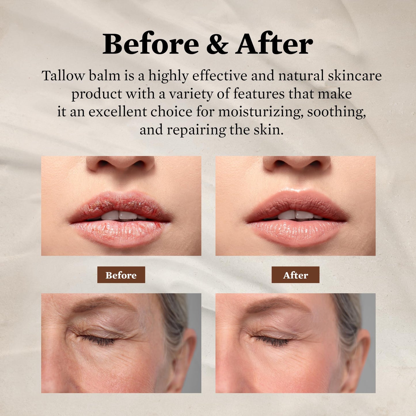 FJALLUFT Tallow Face Moisturizer for Women – Grass-Fed Beef Tallow, Manuka Honey & Olive Oil