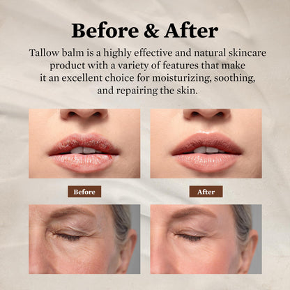 FJALLUFT Tallow Face Moisturizer for Women – Grass-Fed Beef Tallow, Manuka Honey & Olive Oil