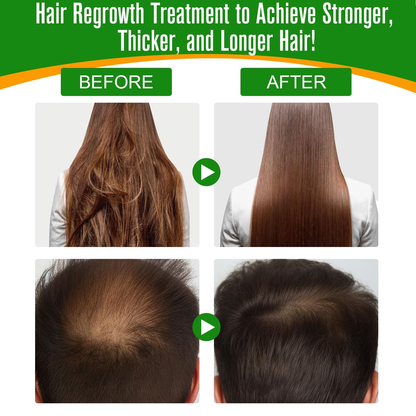 Flasture Batana Oil for Hair Growth – 100% Pure, 2.02 fl oz