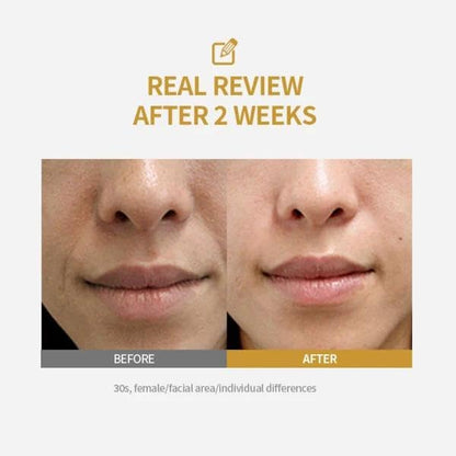 Fneute Silk Peptide Intensive Lifting Ampoule | Moisturizes, Firms & Lifts | Korean Anti-Aging Facial Essence 50ml
