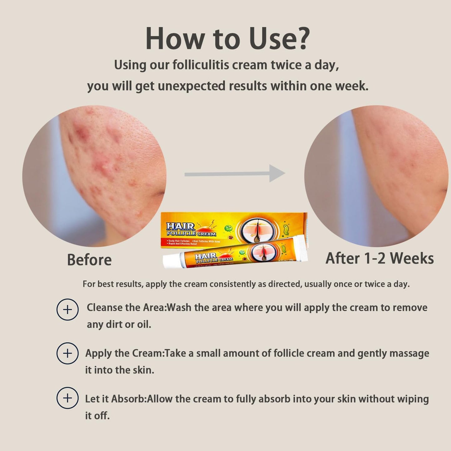 Folliculitis Cream – Effective Folliculitis Treatment for Scalp, Face & Body | 1.42 Oz