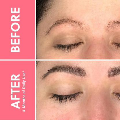 ForBrow by ForChics: 3-Pack Eyebrow Serum for Fuller Brows | Vegan & Cruelty-Free