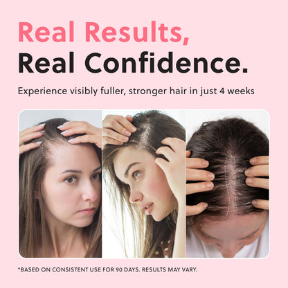 ForChics Hair Growth Serum for Women – Hormone-Free, Results in 4 Weeks | Fast-Absorbing Scalp Spray 50ml