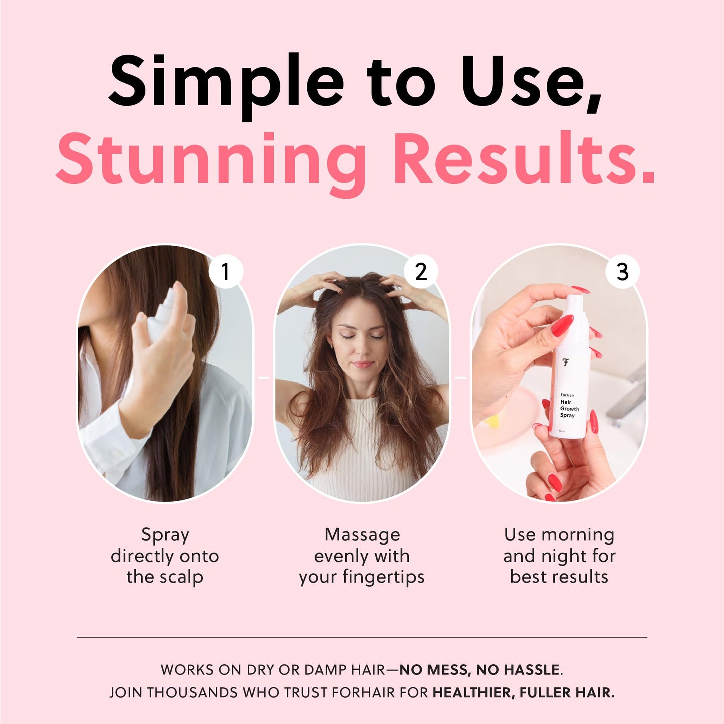 ForChics Hair Growth Serum for Women – Hormone-Free, Results in 4 Weeks | Fast-Absorbing Scalp Spray 50ml