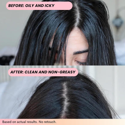 FoxyBae Volumizing Dry Shampoo with Biotin – For Dark, Brunette & Blonde Hair