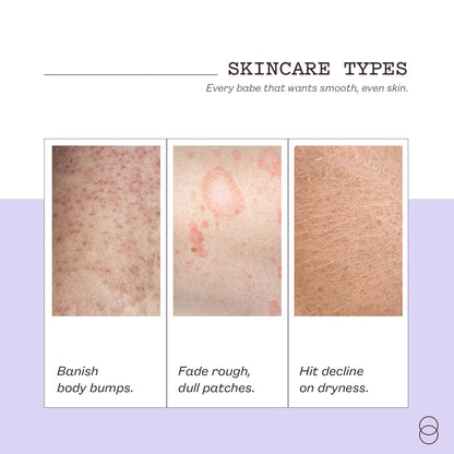 frank body Niacinamide Body Scrub – Berry Extracts & Green Tea | 250g