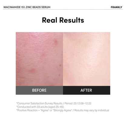 FRANKLY Niacinamide 15% + Zinc Bead Serum | Gentle, Oil-Balancing Skin Support