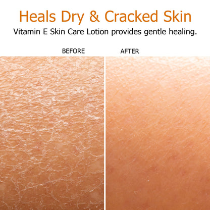 Fruit of the Earth Vitamin E Lotion 16 oz – 2 Pack | Gentle Moisturizing Lotion