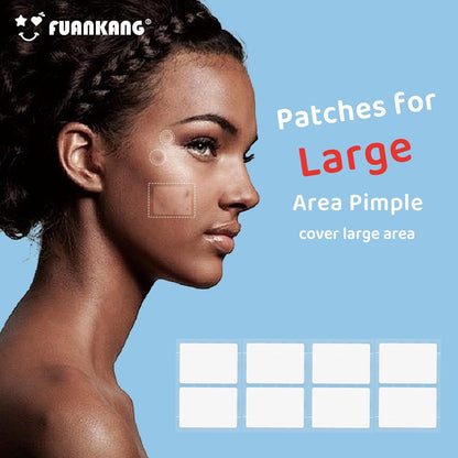 FUANKANG Pimple Patches – Hydrocolloid Face Patches, Yellow-Green Laser Heart, Mirror Case (Large, 104 Count)