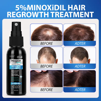 FUZYAT 5% Minoxidil Hair Growth Spray for Men & Women – Biotin, 60ml