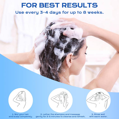 FYZMTL Anti-Dandruff Shampoo for Folliculitis & Scalp Psoriasis | Flake Control & Itch Relief