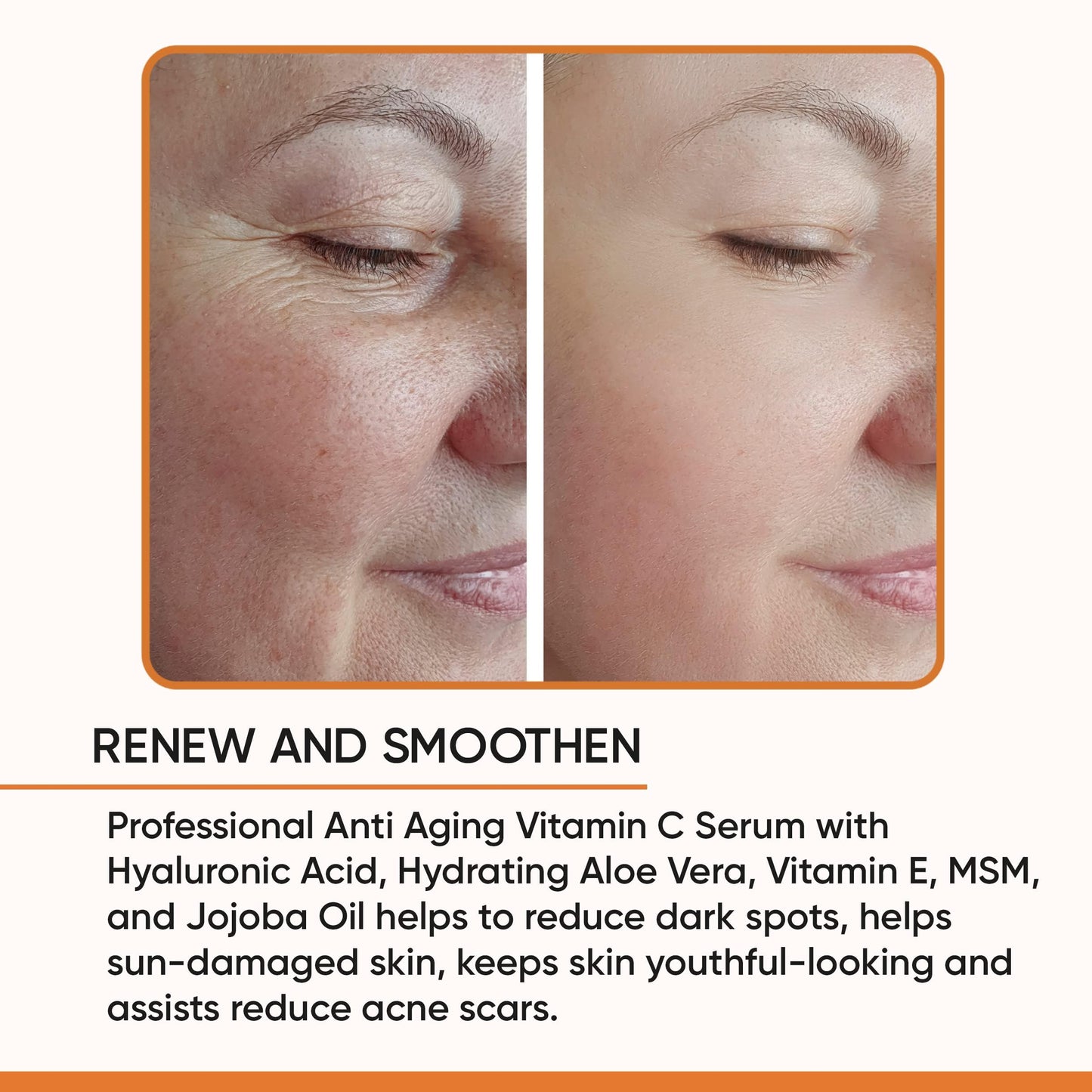 Gaudy Guru 100% Pure Vitamin C Serum for Face – Anti-Aging with Hyaluronic Acid
