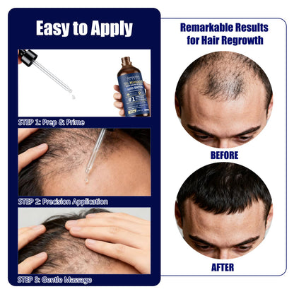 Gemächlich Zu Hause 5% Minoxidil for Men – Biotin, Rosemary & Caffeine, 100ml