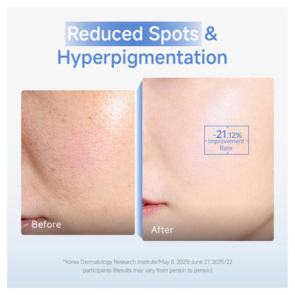 DAERA Synergy Boost Ampoule – Korean Brightening & Hydrating Serum, Dark Spot Correcting & Anti-Aging (30ml)