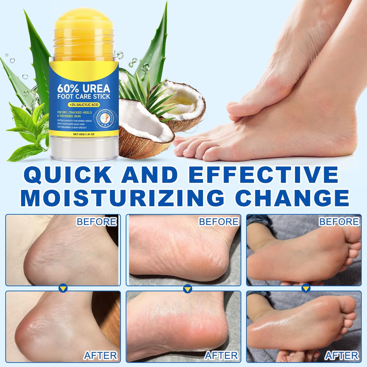 Generic Urea 60% Cream Stick with Salicylic Acid 2% | Intensive Hydration for Feet & Hands (40g)