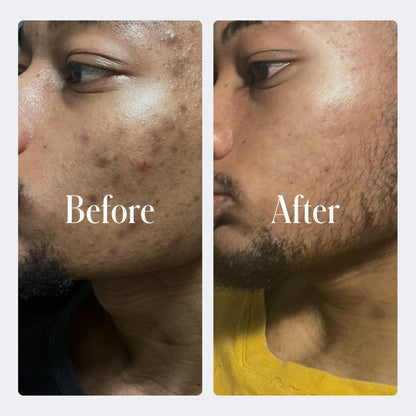 Geologie Complete Skincare Set — 3-Month Simple Daily Routine for Clear Skin