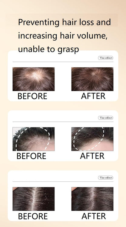 Ginaday 2 Box Ginger Plant Extract Shampoo for Hair Growth & Thinning Hair Support